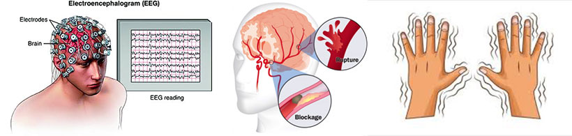 neurology